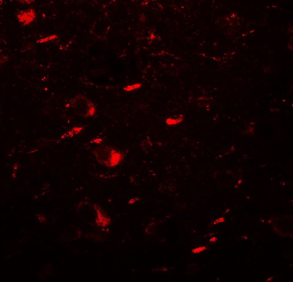 IHC-plus™ MAP1LC3B / LC3B Antibody