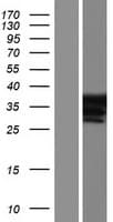 Human NR1I3 / CAR Protein (Over-Expression Lysate Myc-DDK (Flag))