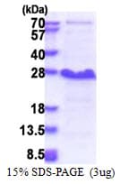 Human NDFIP1 / N4WBP5 Protein (Recombinant His)