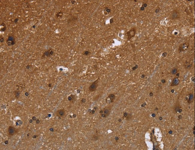 Polyclonal Rabbit anti-Human FRK Antibody (IHC, WB)