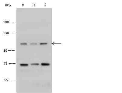 THSD1 / TMTSP Antibody (Preservative Free)