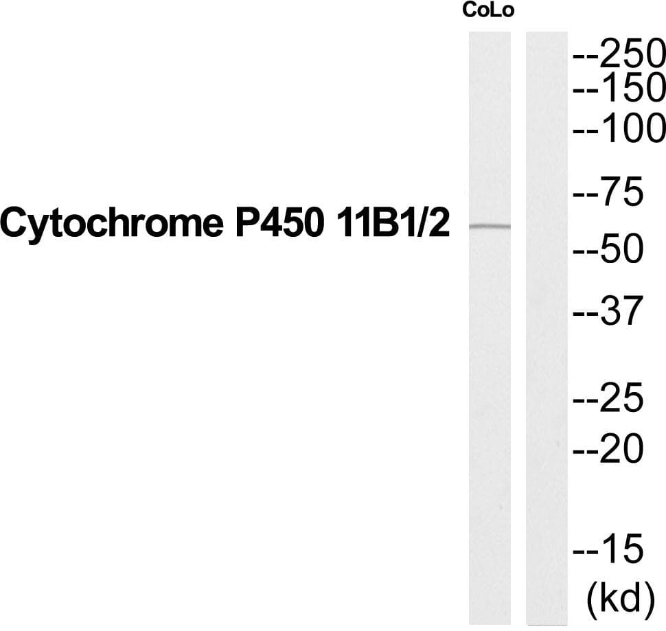 CYP11B1+2 Antibody
