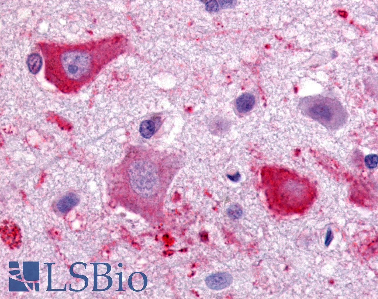 IHC-plus™ Polyclonal Rabbit anti-Human CHEMR23 / CMKLR1 Antibody (C-Terminus, IHC)