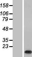 C19orf56 Protein (Over-Expression Lysate Myc-DDK (Flag))