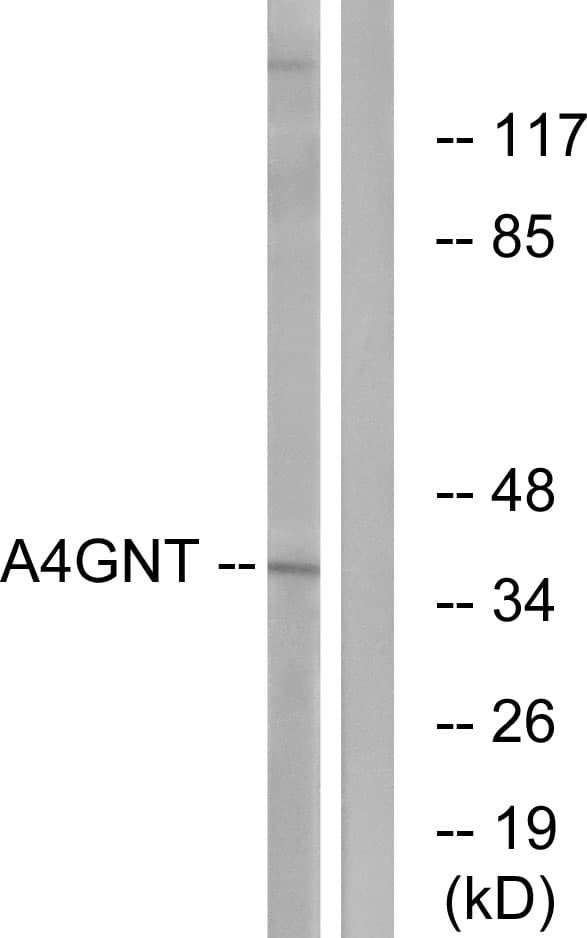 Polyclonal Rabbit anti-Human Alpha4GnT / A4GNT Antibody (aa31-80, WB)