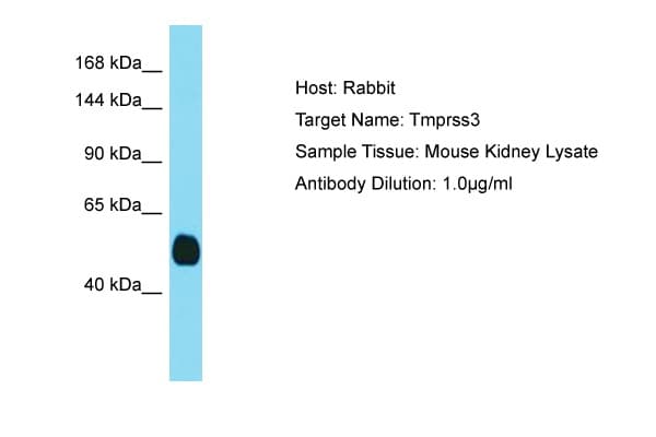 TMPRSS3 Antibody (aa401-450)