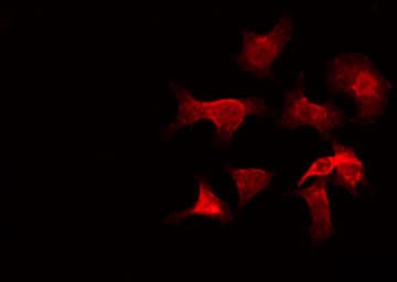 Polyclonal Rabbit anti-Human GZMH / Granzyme H Antibody (IHC, IF, WB)