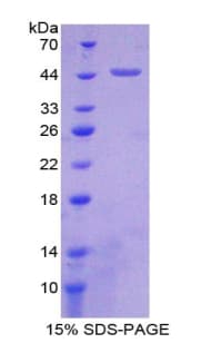 Rat ADGRE5 / CD97 Protein (Recombinant His-GST)