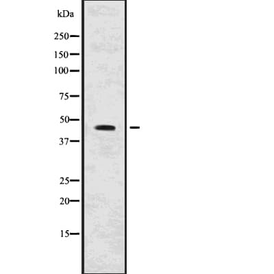 AGTR1 / AT1 Receptor Antibody