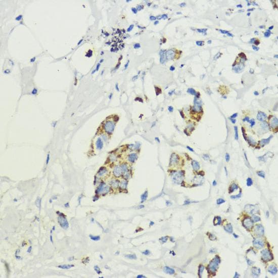 AKT1S1 / PRAS40 Antibody