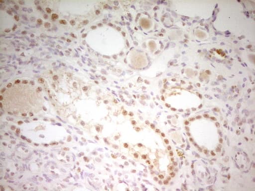 ATF1 Antibody (clone OTI5D10)