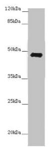 Polyclonal Rabbit anti-Human E2F1 Antibody (IHC, WB)