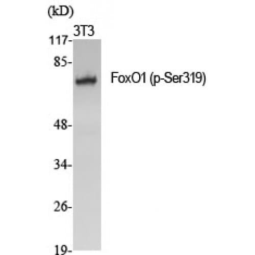 FOXO1 / FKHR Antibody (260-340 aa)