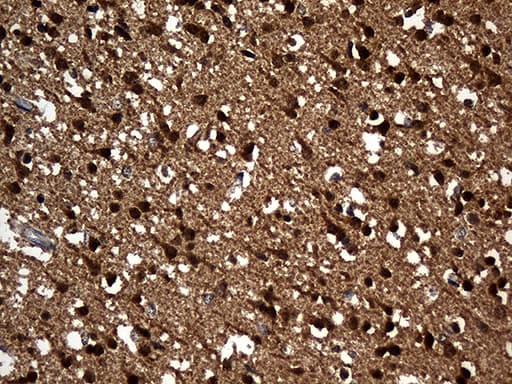 PPP3CA / CCN1 / Calcineurin A Antibody (aa2-105, clone OTI5C6)