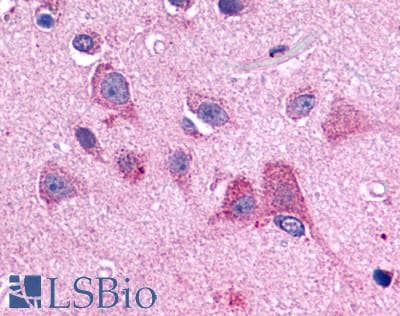 PathPlus™ HTR2B / 5-HT2B Receptor Antibody (Extracellular Domain)