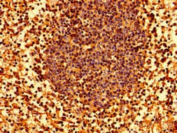 Polyclonal Rabbit anti-Human HLA Class I Histocompatibility Antigen, C-4 Alpha Chain Antibody (IHC, WB)