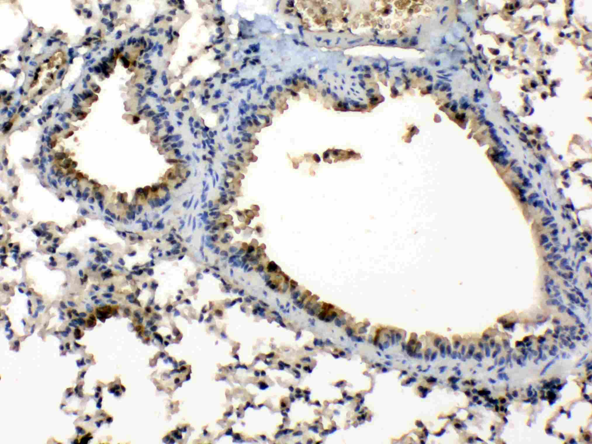 PPL / Periplakin Antibody