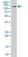 PathPlus™ CDH17 / Cadherin 17 Antibody (clone 1H3)