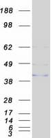 Human ANTXR1 / TEM8 Protein (Recombinant Myc-DDK (Flag))