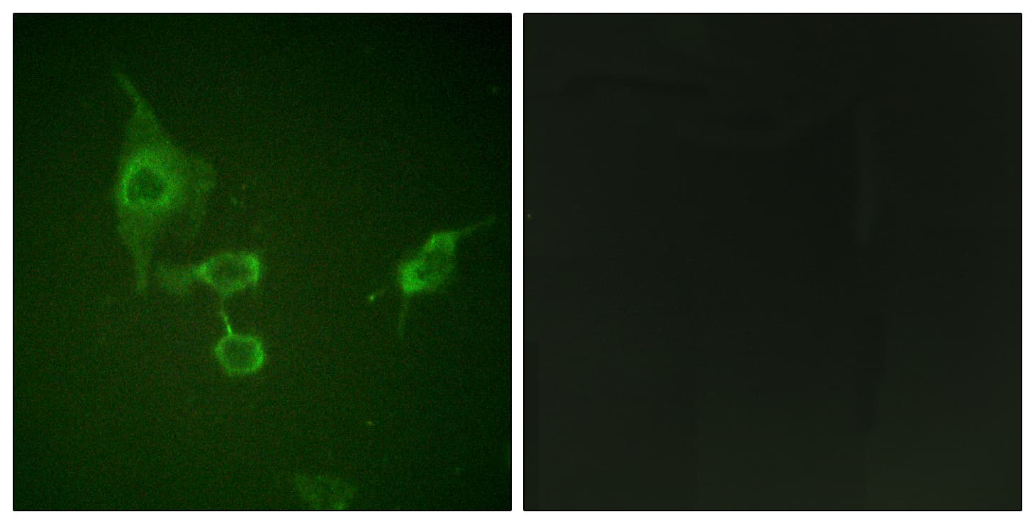 HCK Antibody (aa381-430)