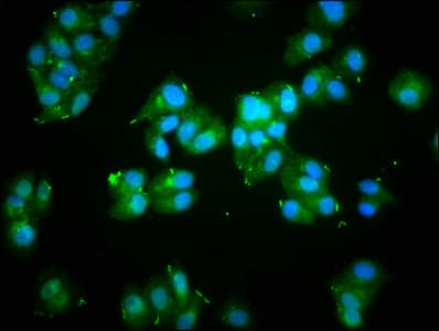 ACTA1 / Skeletal Muscle Actin Antibody
