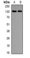 Polyclonal Rabbit anti-Mouse EPHA4 / EPH Receptor A4 Antibody (WB)