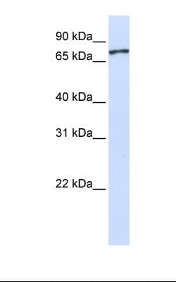 Polyclonal Rabbit anti-Human UNC5A Antibody (aa326-375, IHC, WB)