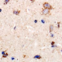 LRP10 Antibody