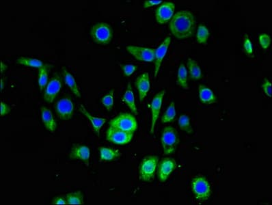 Polyclonal Rabbit anti-Human SNRPD1 / SMD1 Antibody