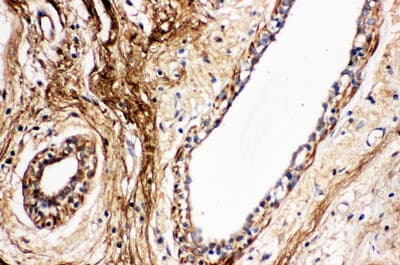 Polyclonal Rabbit anti-Human PROC / Protein C Antibody (aa446-461, IHC, WB)