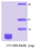 Human SNCA / Alpha-Synuclein Protein (Recombinant)