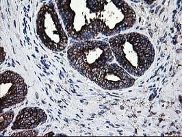 MAC-2-BP / LGALS3BP Antibody (clone OTI3G8)