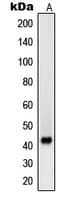 SGCB / SGC / Sarcoglycan Beta Antibody (Internal)