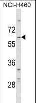 SMIF / DCP1A Antibody (aa146-175)