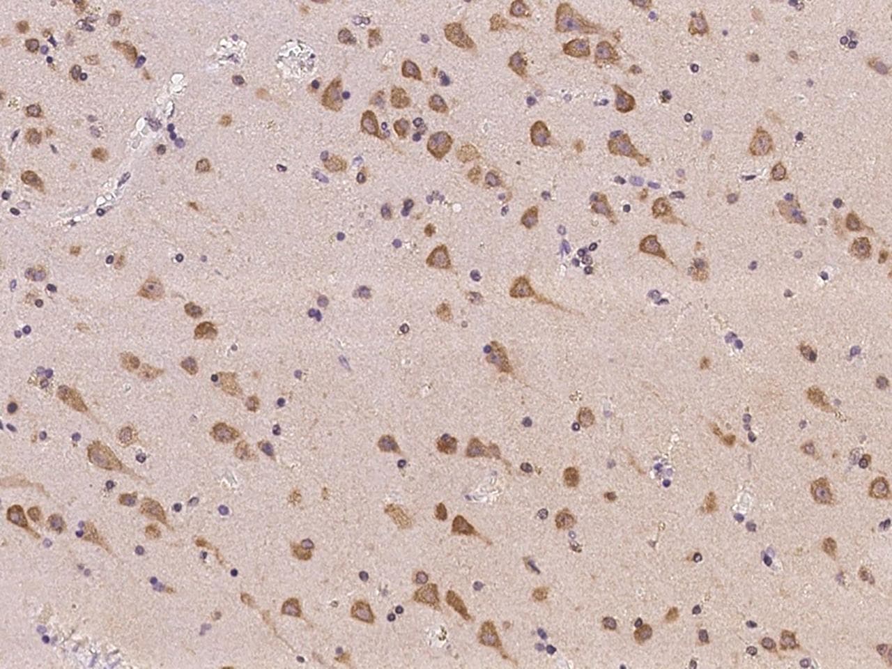 Polyclonal Rabbit anti-Human PNMAL2 Antibody (IHC)