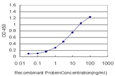 Monoclonal Mouse anti-Human PTCH1 / Patched 1 Antibody (clone 1G2, WB)