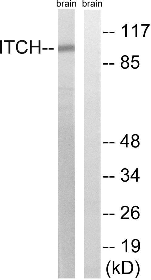 Polyclonal Rabbit anti-Human ITCH / AIP4 Antibody (p420, WB)