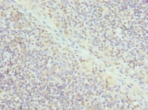 Polyclonal Rabbit anti-Human ELF1 Antibody (IHC)