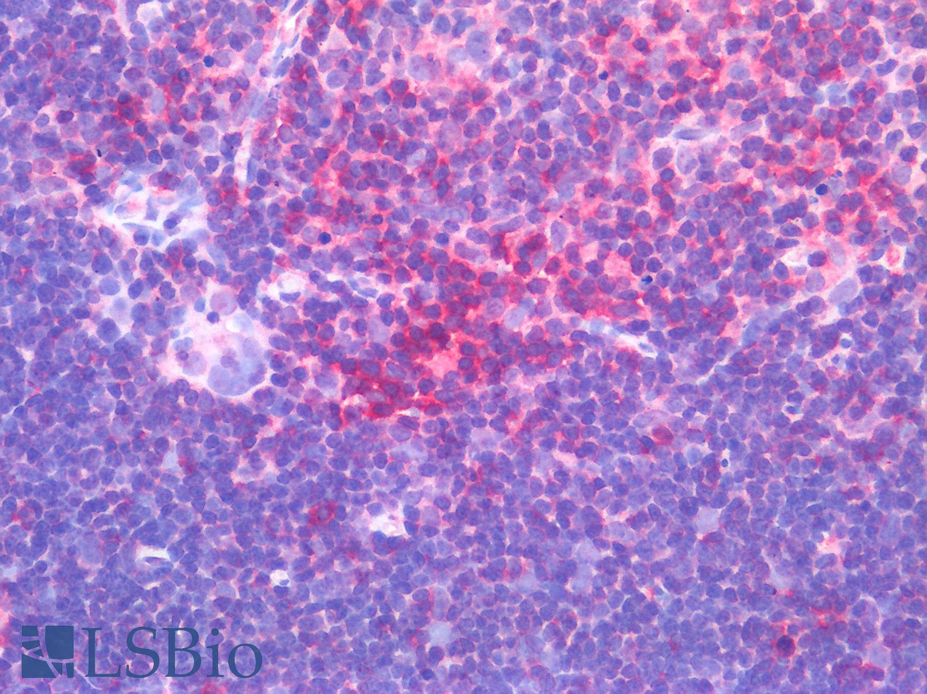 IHC-plus™ Polyclonal Rabbit anti-Human CD45 / LCA Antibody (IHC)