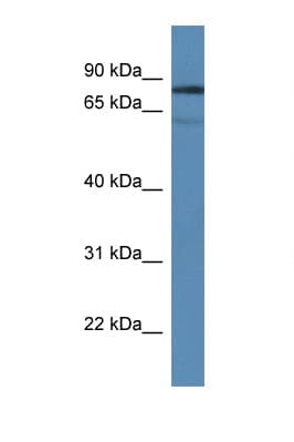 TDP1 Antibody (aa350-399)