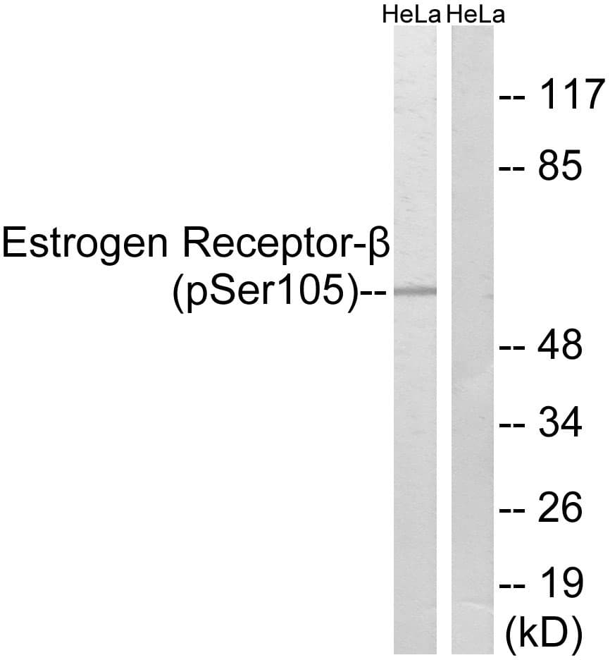 ESR2 / ER Beta Antibody (phospho-Ser105)