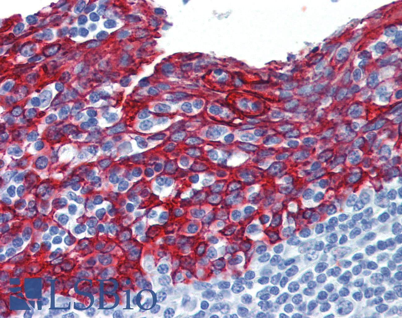 PathPlus™ Pan Cytokeratin Antibody (clone 7H8)