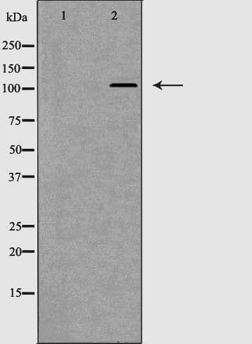 ITGA2B / CD41 Antibody