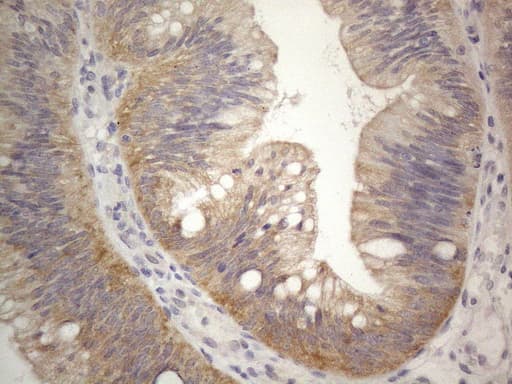 PRMT5 Antibody (aa238-499, clone OTI2H3)