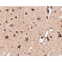 APG12 / ATG12 Antibody