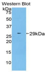 TNPO1 / Transportin 1 Antibody (aa593-836, PE)