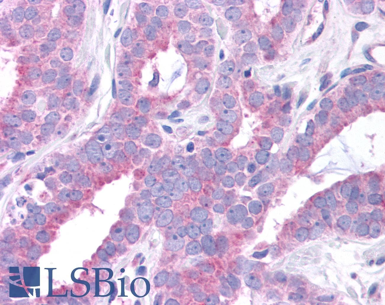 PathPlus™ Polyclonal Rabbit anti-Human GPER1 / GPR30 Antibody (C-Terminus, IHC, IF, WB)