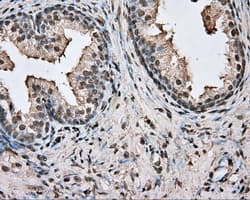 Basigin / Emmprin / CD147 Antibody (clone OTI3E5)