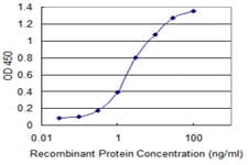 Monoclonal Mouse anti-Human RBM10 Antibody (clone 2F12, WB)