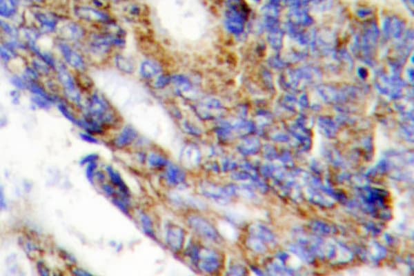 COL1A2 / Collagen I Alpha 2 Antibody (Thr501)